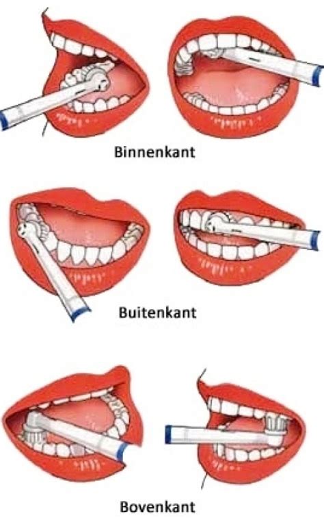 Illustratie van de 3 B's (Binnenkant, Buitenkant, Bovenkant) voor tandenpoetsen