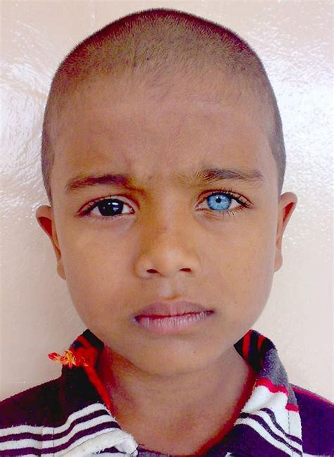 Afbeelding van een persoon met lichtblauwe ogen