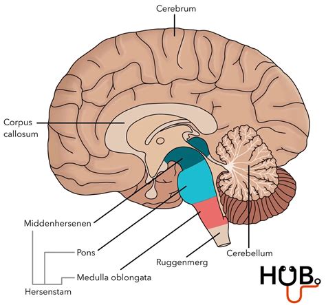 Schematische tekening van een doorsnede door het midden van de hersenen met de locatie van verschillende kindertumoren.