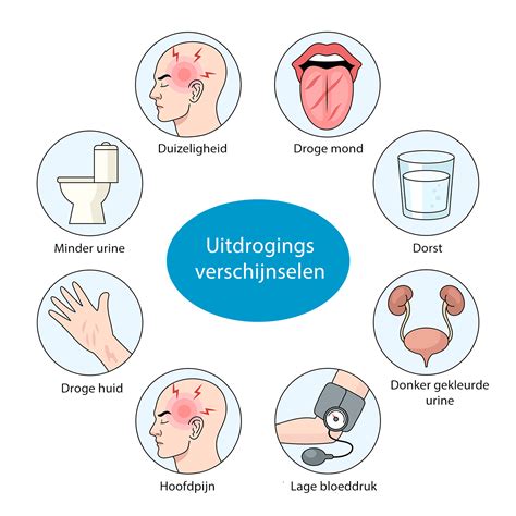 Een schema met de symptomen van uitdroging bij baby's.