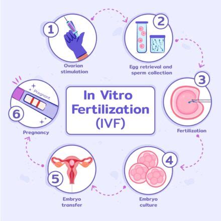 Infographic met veelvoorkomende bijwerkingen van IVF