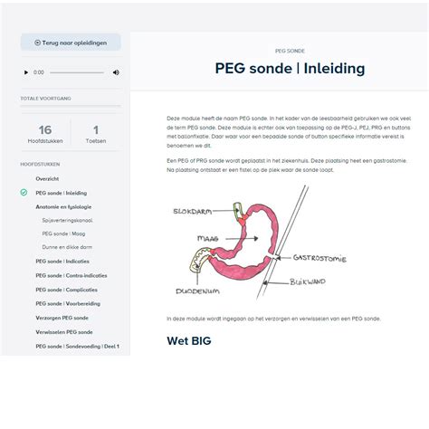 Schema van de juiste plaatsing van de lancet bij de hielprik.