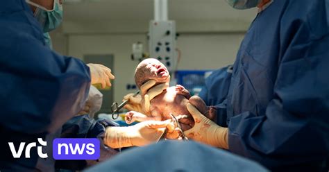 Illustratie van een baby die na een keizersnede op de borst van de moeder wordt gelegd.