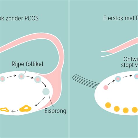 Schema dat het verloop van vruchtbaarheidsbehandelingen (IVF/IUI) en de impact ervan op de werksituatie illustreert.