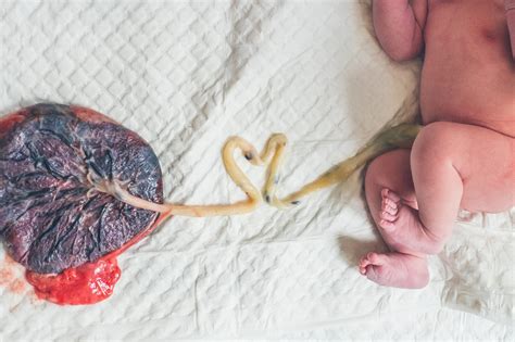 Een gedetailleerde afbeelding van de moederkoek (placenta) met de navelstreng en vliezen.