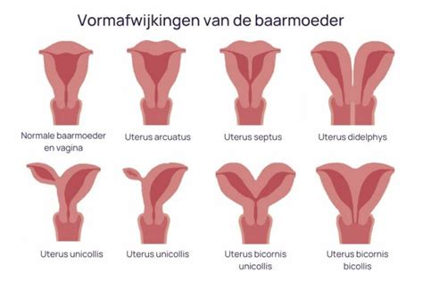 Infographic die de verschillende soorten babyposities in de baarmoeder toont.